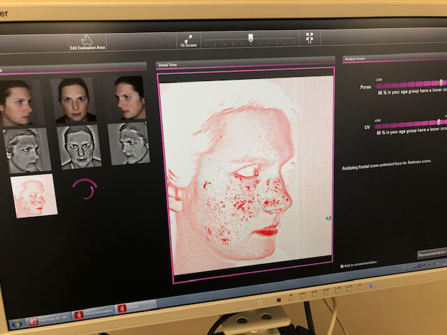 Komputerowa analiza skóry twarzy w CM Medevac
