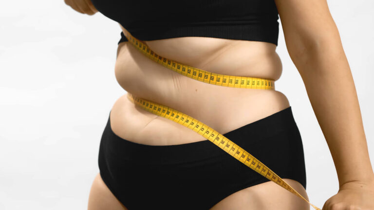 Redukcja tkanki tłuszczowej — zabiegi, dieta i ćwiczenia